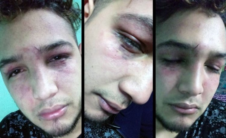Denuncian que patovicas de El Santo golpearon a un joven