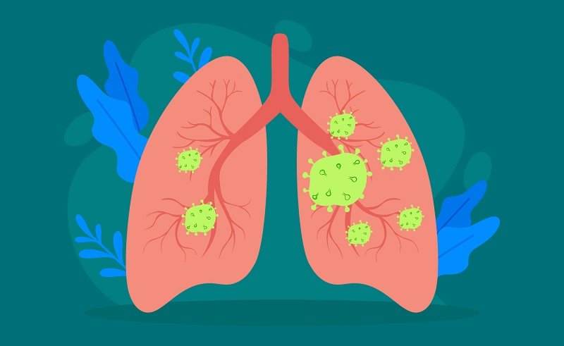 Desarrollo y elaboración de medicación inhalable para fibrosis quística