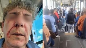 El chofer sufrió algunos rasguños en la cara.