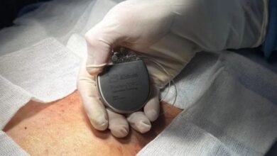 Cirugía. Histórica operación por primera vez en 65 años