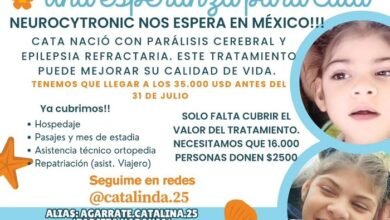 Catalina nació con microcefalia severa.