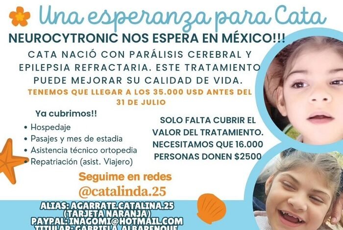 Catalina nació con microcefalia severa.