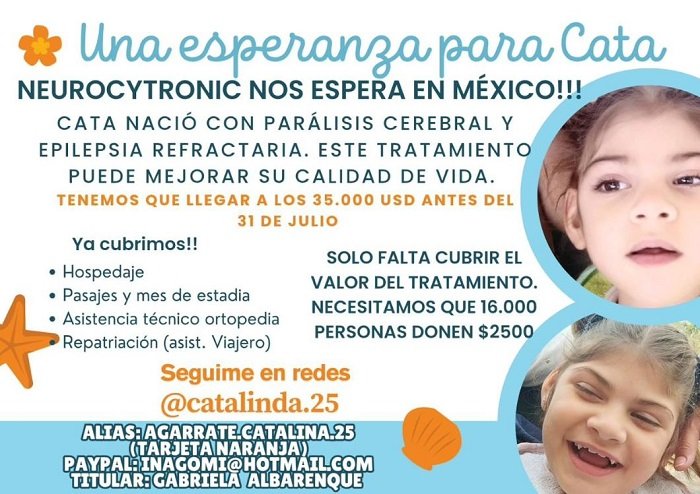 Catalina nació con microcefalia severa.