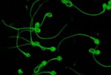 Conicet. HyperSperm: el avance científico argentino.