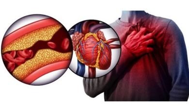 Infartos en Argentina: una problemática que afecta.