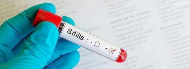 Sífilis. Un avance silencioso marcado por menos prevención.