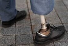 Cirugía. Una cirugía transformó el uso de prótesis.