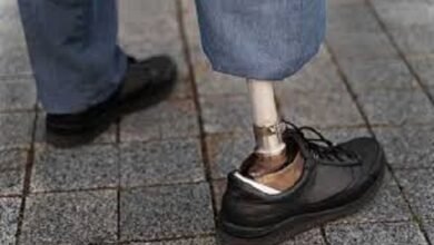 Cirugía. Una cirugía transformó el uso de prótesis.