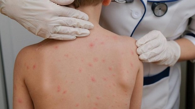 Vacunación.  La OPS insta a reforzar la vacunación.