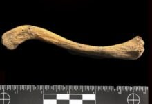 ADN antiguo. Bacteria asociada a la sífilis.