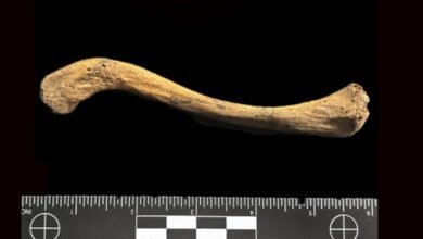 ADN antiguo. Bacteria asociada a la sífilis.