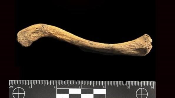 ADN antiguo. Bacteria asociada a la sífilis.