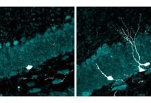 La estimulación multisensorial abre nuevas vías.