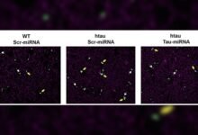 Avance. Nuevas puertas contra enfermedades neurodegenerativas