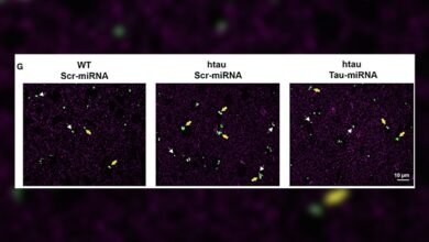 Avance. Nuevas puertas contra enfermedades neurodegenerativas