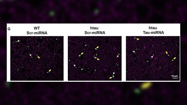 Avance. Nuevas puertas contra enfermedades neurodegenerativas