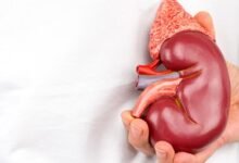 Salud renal: la importancia de la prevención.