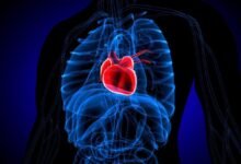 Enfermedades. Cómo reconocer la miocardiopatía de Takotsubo.