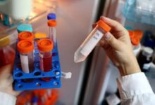 Investigadores de la UNLP analizan el sedentarismo.