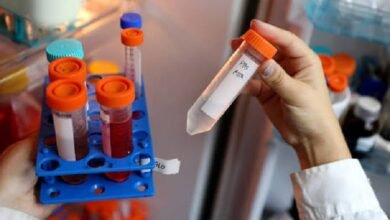 Investigadores de la UNLP analizan el sedentarismo.