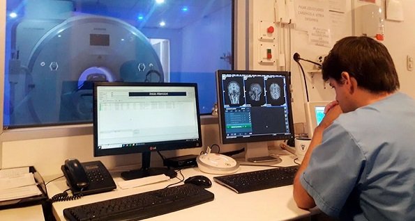 CONICET. Investigan cómo se reorganiza el cerebro.